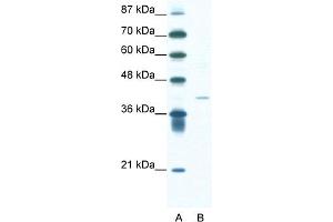 WB Suggested Anti-HIF1AN Antibody Titration:  1. (HIF1AN 抗体  (N-Term))