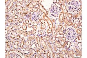 Paraformaldehyde-fixed, paraffin embedded rat kidney tissue, Antigen retrieval by boiling in sodium citrate buffer(pH6) for 15min, Block endogenous peroxidase by 3% hydrogen peroxide for 30 minutes, Blocking buffer (normal goat serum) at 37°C for 20min, Antibody incubation with Rabbit Anti-SIRT4 Polyclonal Antibody, Unconjugated  at 1:400 overnight at 4°C, followed by a conjugated secondary and DAB staining (SIRT4 抗体  (AA 51-150))