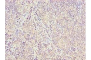Immunohistochemistry of paraffin-embedded human tonsil tissue using ABIN7157054 at dilution of 1:100 (ISCA2 抗体  (AA 9-154))