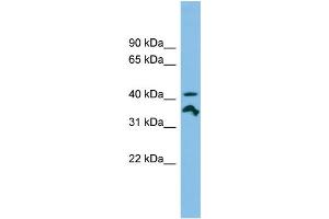 WB Suggested Anti-RRAGC Antibody Titration: 0. (GTR2 抗体  (N-Term))