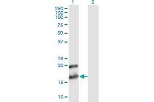 Western Blot analysis of PTN expression in transfected 293T cell line by PTN monoclonal antibody (M02), clone 2E3. (Pleiotrophin 抗体  (AA 45-154))