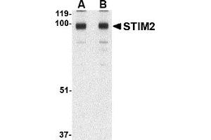 Western Blotting (WB) image for anti-Stromal Interaction Molecule 2 (Stim2) (C-Term) antibody (ABIN1030707)