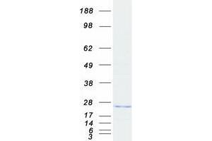 Western Blotting (WB) image for ADP-Ribosylation Factor-Like 8B (ARL8B) protein (Myc-DYKDDDDK Tag) (ABIN2714918)