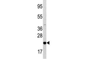 Western blot analysis of Bad antibody and HL-60 lysate. (BAD 抗体  (AA 53-81))
