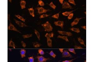 Immunofluorescence analysis of L929 cells using CYR61 Polyclonal Antibody at dilution of 1:100. (CYR61 抗体)