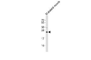 All lanes : Anti-Ctf1 Antibody at 1:2000 dilution + mouse skeletal muscle lysates Lysates/proteins at 20 μg per lane. (Cardiotrophin 1 抗体)