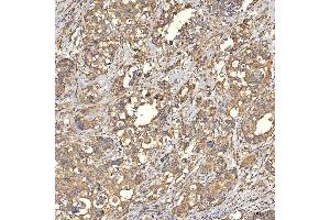 IHC analysis of TST using anti-TST antibody (ABIN7599105). (TST 抗体  (AA 1-220))