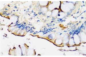 Immunohistochemistry of paraffin-embedded Human colon using CRTAP Polyclonal Antibody at dilution of 1:100 (40x lens). (CRTAP 抗体)