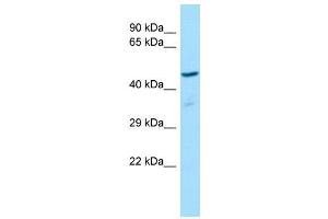 Host:  Rabbit  Target Name:  RGD1311188  Sample Type:  Rat Thymus lysates  Antibody Dilution:  1. (RGD1311188 抗体  (Middle Region))