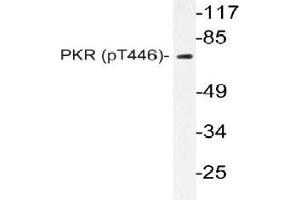 Western blot (WB) analyzes of p-PKR (pThr446) antibody in extracts from NIH-3T3 IFN cells. (EIF2AK2 抗体  (pThr446))