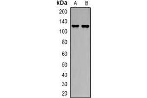 Western blot analysis of NBC1 expression in PC3 (A), A549 (B) whole cell lysates. (SLC4A4 抗体)