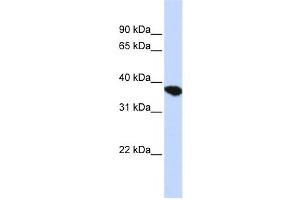 Western Blotting (WB) image for anti-ST8 alpha-N-Acetyl-Neuraminide alpha-2,8-Sialyltransferase 4 (ST8SIA4) antibody (ABIN2459219)