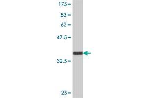 Western Blot detection against Immunogen (34. (JAZF1 抗体  (AA 165-243))