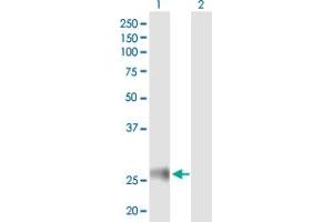Western Blot analysis of HLA-DRB4 expression in transfected 293T cell line by HLA-DRB4 MaxPab polyclonal antibody. (HLA-DRB4 抗体  (AA 1-266))
