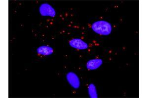 Proximity Ligation Analysis of protein-protein interactions between AKT1 and MTOR. (MTOR 抗体  (AA 1521-1620))
