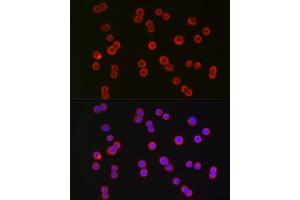 Immunofluorescence analysis of HT-29 cells using CFTR Rabbit pAb (ABIN6129855, ABIN6138469, ABIN6138470 and ABIN6224429) at dilution of 1:150 (40x lens).