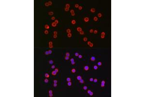 Immunofluorescence analysis of HT-29 cells using CFTR Rabbit pAb (ABIN6129855, ABIN6138469, ABIN6138470 and ABIN6224429) at dilution of 1:150 (40x lens). (CFTR 抗体  (AA 1161-1480))