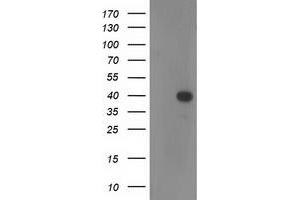 Western Blotting (WB) image for anti-Reticulon 4 Interacting Protein 1 (RTN4IP1) antibody (ABIN1500772) (RTN4IP1 抗体)