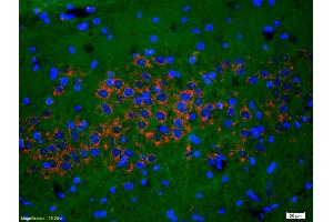 Immunofluorescence (IF) image for anti-Glutamate Receptor, Ionotropic, N-Methyl D-Aspartate 1 (GRIN1) (pSer890) antibody (ABIN744278)
