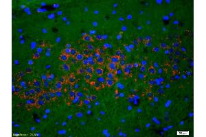 Formalin-fixed and paraffin-embedded rat brain labeled with Anti-Phospho-NMDAR1(Ser890) Polyclonal Antibody, Unconjugated (ABIN744278) 1:200, overnight at 4°C, The secondary antibody was Goat Anti-Rabbit IgG, Cy3 conjugated used at 1:200 dilution for 40 minutes at 37°C. (GRIN1/NMDAR1 抗体  (pSer890))