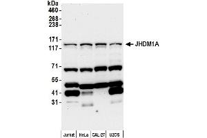 Western Blotting (WB) image for anti-Lysine (K)-Specific Demethylase 2A (KDM2A) (AA 825-875) antibody (ABIN7453635)