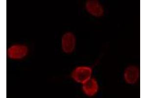 ABIN6274197 staining HuvEc cells by IF/ICC. (CDK11 抗体  (N-Term))