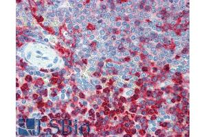Immunohistochemistry staining of human spleen (paraffin sections) using anti-CD18 (Commercially tested by LifeSpan BioSciences. (Integrin beta 2 抗体  (PE))