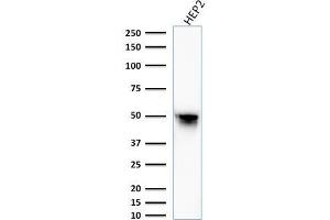 Western Blot Analysis of HEP2 cell lysate using Vimentin Mouse Monoclonal Antibody (VM1170). (Vimentin 抗体)