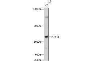Western blot analysis of extracts of HepG2 cells, using HNF1B antibody (ABIN3017358, ABIN3017359, ABIN3017360, ABIN1680315 and ABIN1680316) at 1:1000 dilution. (HNF1B 抗体  (AA 100-200))
