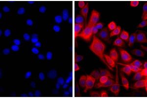 Human pancreatic carcinoma cell line MIA PaCa-2 was stained with Mouse Anti-Cytokeratin 18-UNLB and DAPI. (山羊 anti-小鼠 IgG (Heavy & Light Chain) Antibody - Preadsorbed)