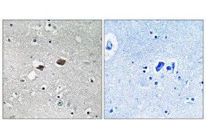 Immunohistochemistry (IHC) image for anti-Tigger Transposable Element Derived 3 (TIGD3) (C-Term) antibody (ABIN1852280) (TIGD3 抗体  (C-Term))
