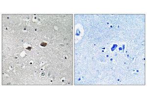 Immunohistochemistry (IHC) image for anti-Tigger Transposable Element Derived 3 (TIGD3) (C-Term) antibody (ABIN1852280) (TIGD3 抗体  (C-Term))