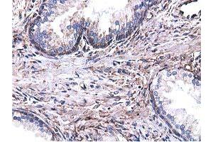 Immunohistochemical staining of paraffin-embedded Human Kidney tissue using anti-CYB5R3 mouse monoclonal antibody. (CYB5R3 抗体)