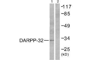 Western Blotting (WB) image for anti-Protein Phosphatase 1, Regulatory (Inhibitor) Subunit 1B (PPP1R1B) (Thr75) antibody (ABIN1847886) (DARPP32 抗体  (Thr75))