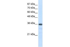 U1SNRNPBP antibody used at 2. (SNRNP35 抗体  (N-Term))