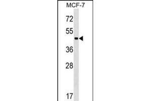 Western Blotting (WB) image for anti-Zinc Finger and BTB Domain Containing 12 (ZBTB12) (AA 413-440), (C-Term) antibody (ABIN1537297)