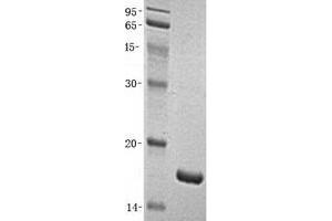Validation with Western Blot (FABP2 蛋白)