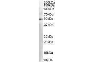 Western Blotting (WB) image for anti-Dopa Decarboxylase (Aromatic L-Amino Acid Decarboxylase) (DDC) (AA 464-475) antibody (ABIN295679) (DDC 抗体  (AA 464-475))