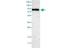 Western blot analysis of Human cell line RT-4 with SH3BP1 polyclonal antibody  at 1:100-1:250 dilution. (SH3BP1 抗体)