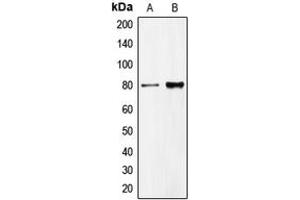 Western blot analysis of CD318 expression in HeLa (A), DU145 (B) whole cell lysates. (CDCP1 抗体  (C-Term))