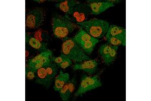 Immunofluorescence Analysis of T98G cells labeling Pgp9. (UCHL1 抗体)