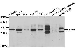 Western blot analysis of extracts of various cell lines, using PDGFB antibody. (PDGFB 抗体)
