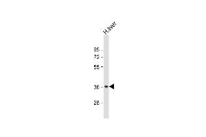 Anti-CTBS Antibody (N-Term) at 1:2000 dilution + human liver lysate Lysates/proteins at 20 μg per lane. (CTBS 抗体  (AA 85-119))