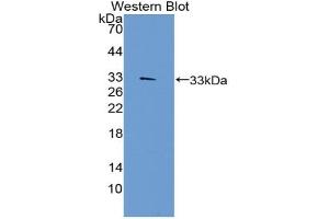 Detection of Recombinant TEP1, Human using Polyclonal Antibody to Telomerase protein component 1 (TEP1) (TEP1 抗体  (AA 2368-2627))