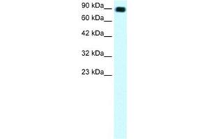Human Daudi; WB Suggested Anti-C13ORF8 Antibody Titration: 1. (ZNF828 抗体  (Middle Region))