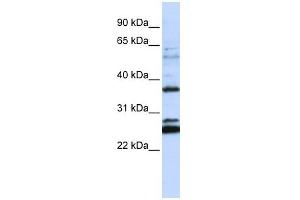 FAM70A antibody used at 1 ug/ml to detect target protein. (FAM70A 抗体  (N-Term))