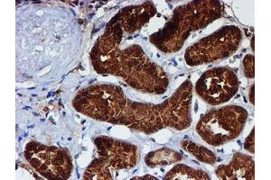 Image no. 1 for anti-Chromosome 1 Open Reading Frame 50 (C1ORF50) antibody (ABIN1497033) (C1ORF50 抗体)
