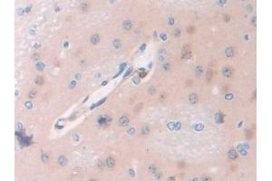 Detection of PDXK in Rat Cerebrum Tissue using Polyclonal Antibody to Pyridoxal Kinase (PDXK)