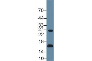 Detection of AQP2 in Human 293T cell lysate using Polyclonal Antibody to Aquaporin 2, Collecting Duct (AQP2) (AQP2 抗体  (AA 177-271))