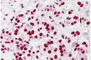 Anti-HnRNP K antibody IHC staining of human adrenal. (HNRNPK 抗体  (AA 200-250))